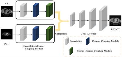 PET and CT Image Fusion of Lung Cancer With Siamese Pyramid Fusion Network